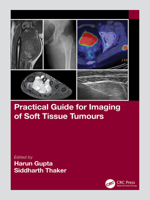 cover image of Practical Guide for Imaging of Soft Tissue Tumours